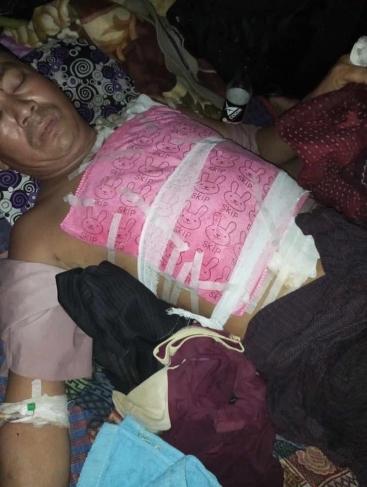 ပုံအညွှန်း- စစ်ကောင်စီတပ်လက်မှ ဓားဒဏ်ရာများဖြင့် လွတ်မြောက်လာသည့် တုမရကျေးရွာဒေသခံ / ပုံ-SRF